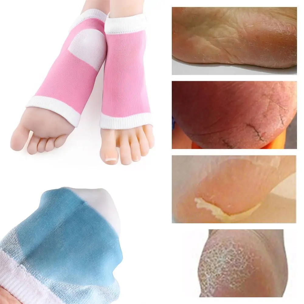 

2pcs Hot Sale Skin Care Tools Anti Dry Exfoliating Anti Cracked Chapped Gel Moisturizing Spa Foot Protector Heel Socks