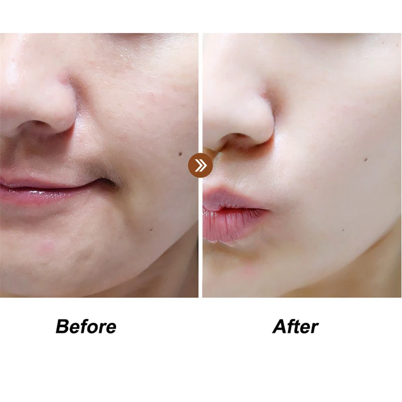 Яичная маска дрожжи яичной скорлупы дрожжей Детский костюм яичная скорлупа