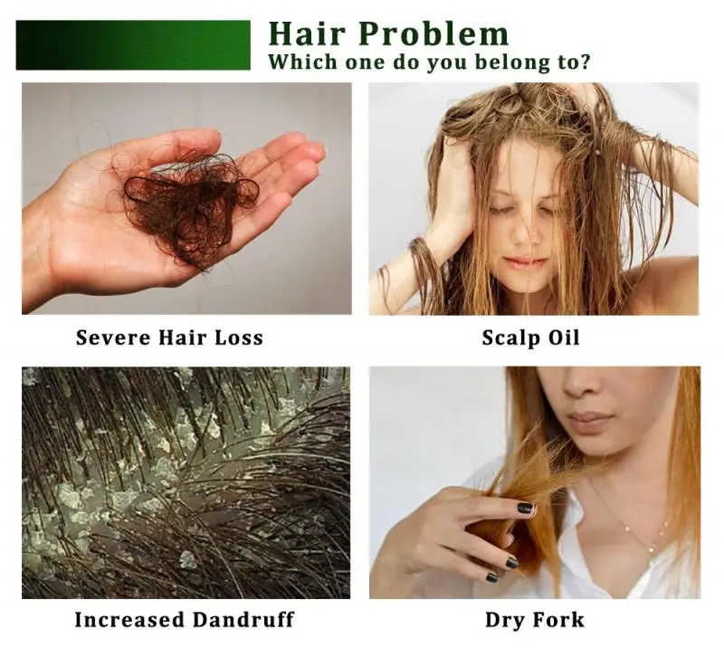 Herbal Hair Treatment Repair root Care Essence Effective Fast Growth Oil Natural Anti hair loss TSLM1 | Красота и здоровье