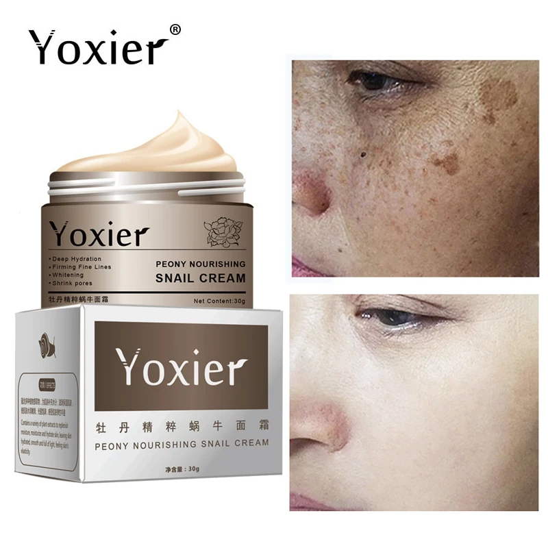 

Yoxier Snail Collagen Face Cream Anti-Wrinkle Whitening Cream Hyaluronic Acid Moisturize Tighten Anti-Aging Nourishing Skin Care