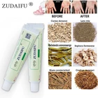 Крем от псориаза Zudaifu, средство для ухода за кожей, лечение дерматита, экземы