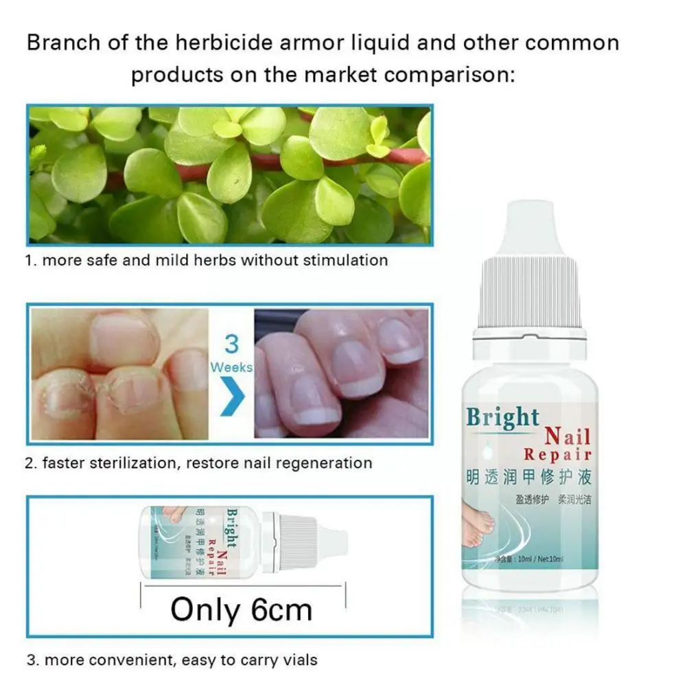 

30ml Nail Repair Essence Nail Toenail Fungus Anti Fungal Oil Serum Cuticle Onychomycosis Nail Foot TSLM1 Care Remove Gel R7T6