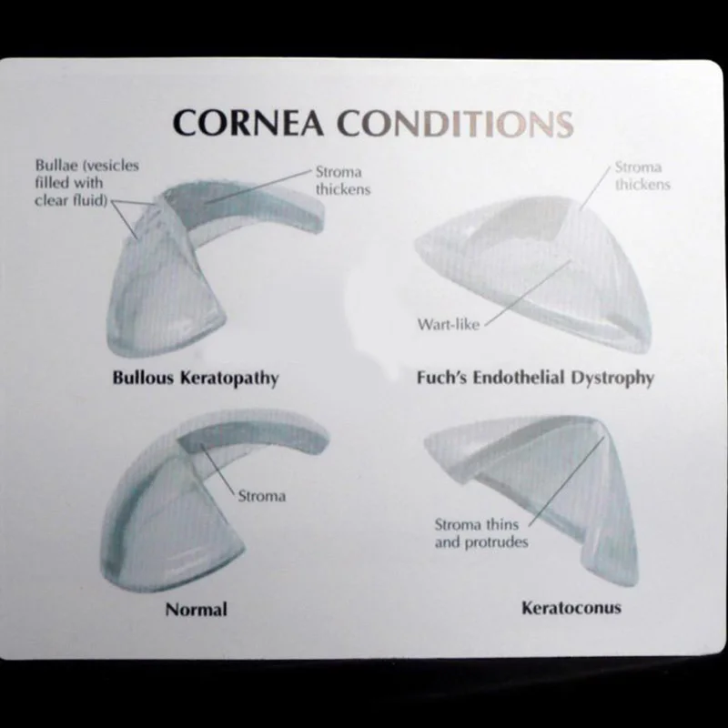 Анатомическая модель в травме анатомический Скелет анатомическая медицинская