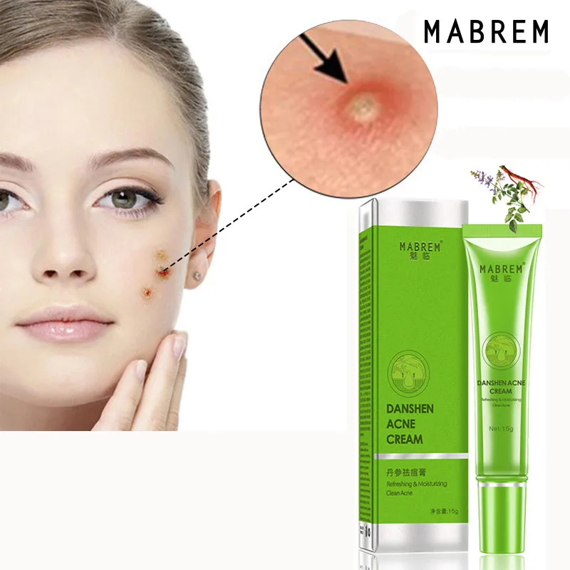 Эффективный крем для удаления акне лечение увлажнение отбеливание уход за кожей