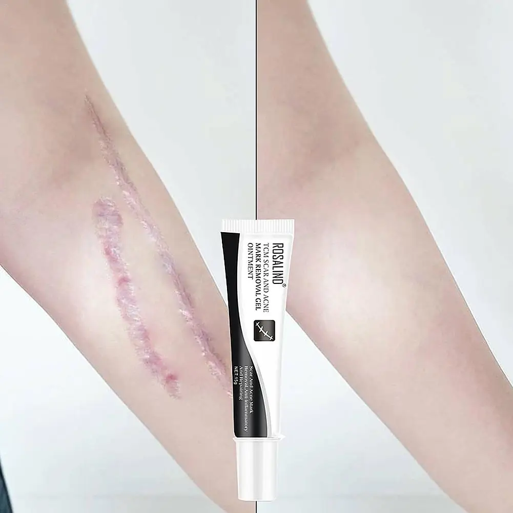 15 г Восстанавливающий шрамовый Крем гель для удаления акне шрамы растяжки шрам