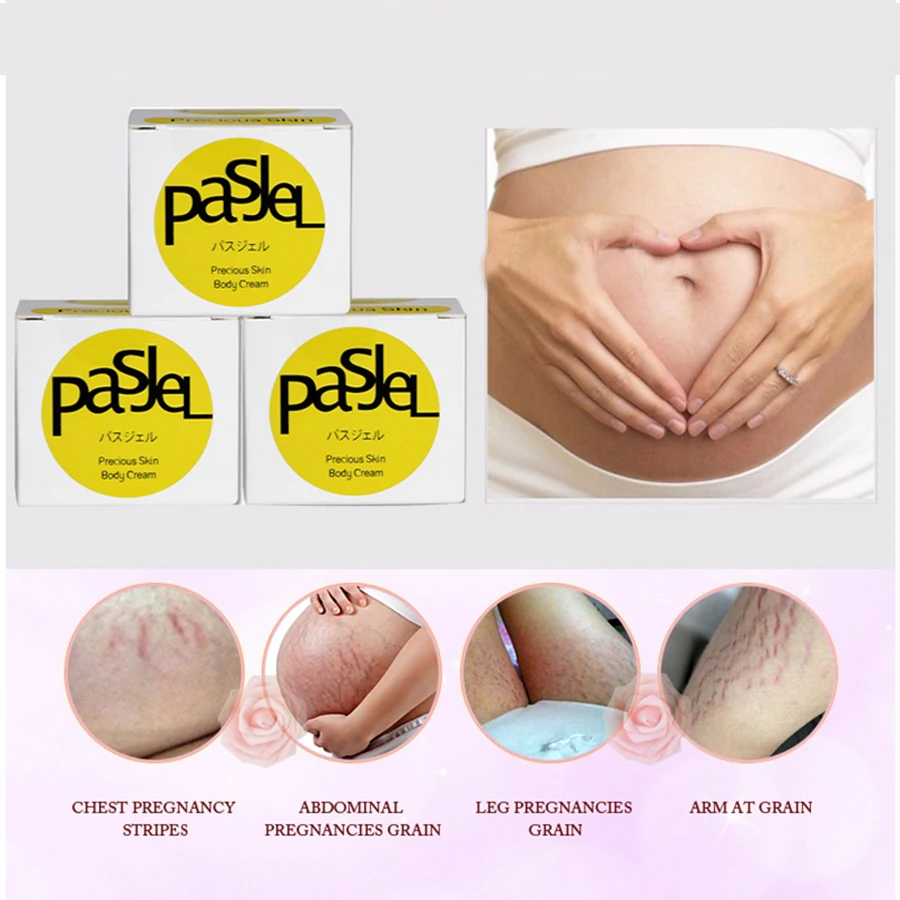 

5Pcs Thailand Pasjel Stretch Marks Remover Scar Removal Powerful Postpartum Obesity Pregnancy Precious Skin Body Repair Cream