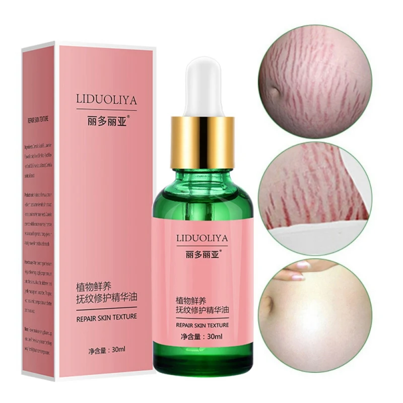 Чистое Натуральное удаление растяжек эфирные масла растяжки для удаления