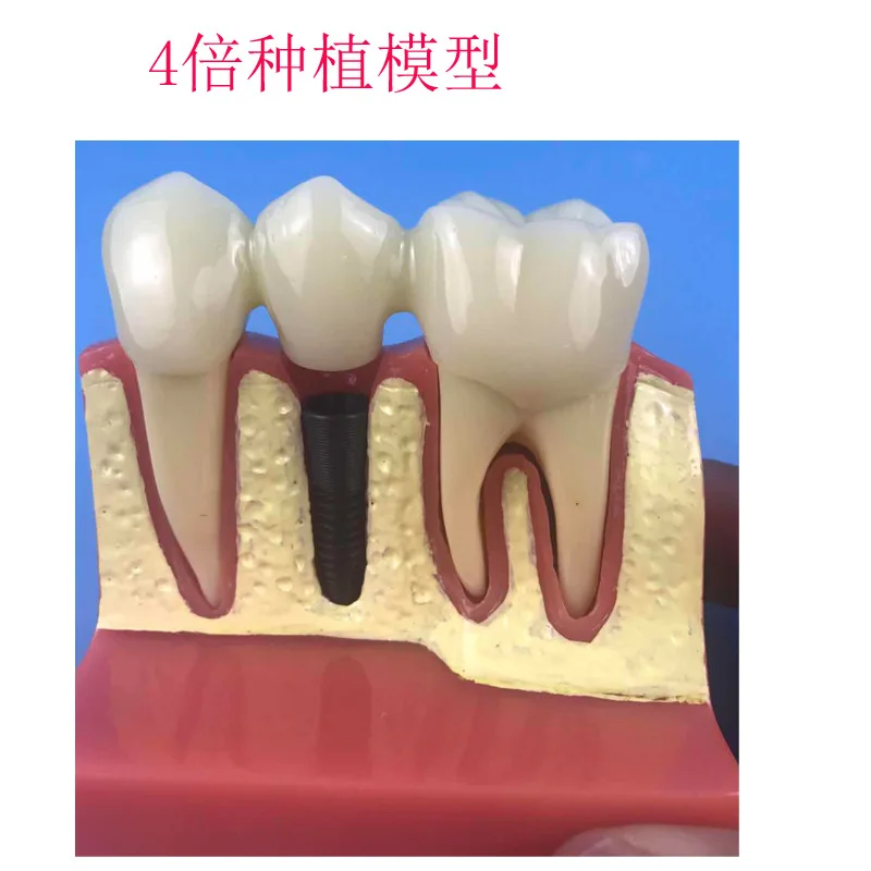 4 кратная модель зуба для полости рта анатомическая медиков учебная продукция