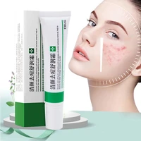 new acne cream oil control shrink pores whitening and moisturizing skin rejuvenation acne cream skin care fade acne spots