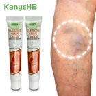 Новый крем для лечения варикозного расширения вен KanyeHB, травяная мазь, экстракты варикозного расширения вен, мощный не раздражающий крем A640, 2 шт.