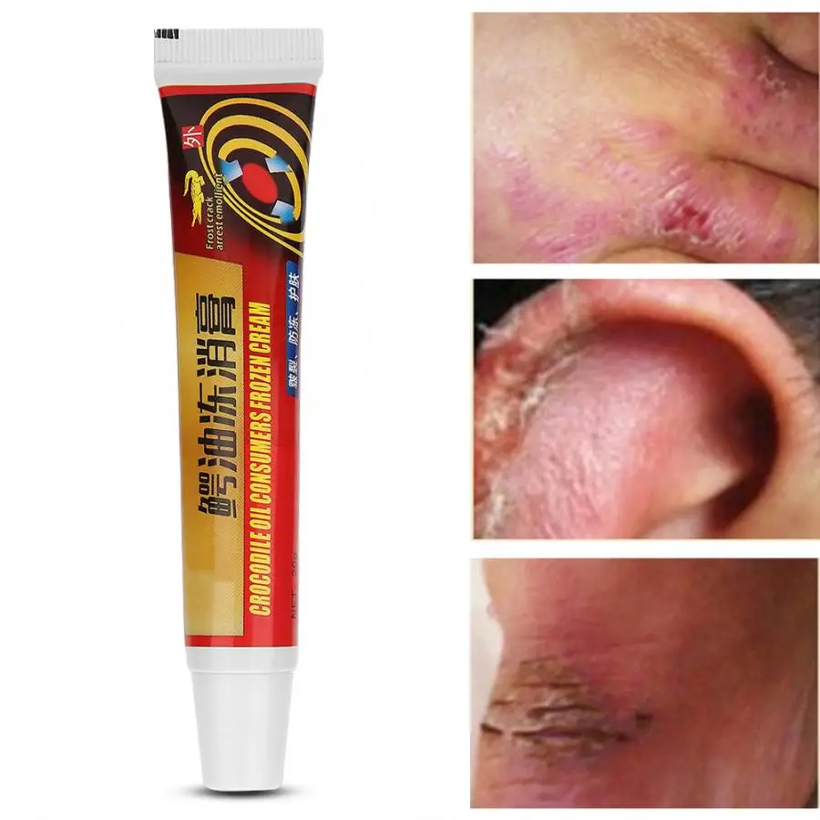 2 шт. детский уход за кожей рук ремонт мазь Лечение трещин питательный крем телом