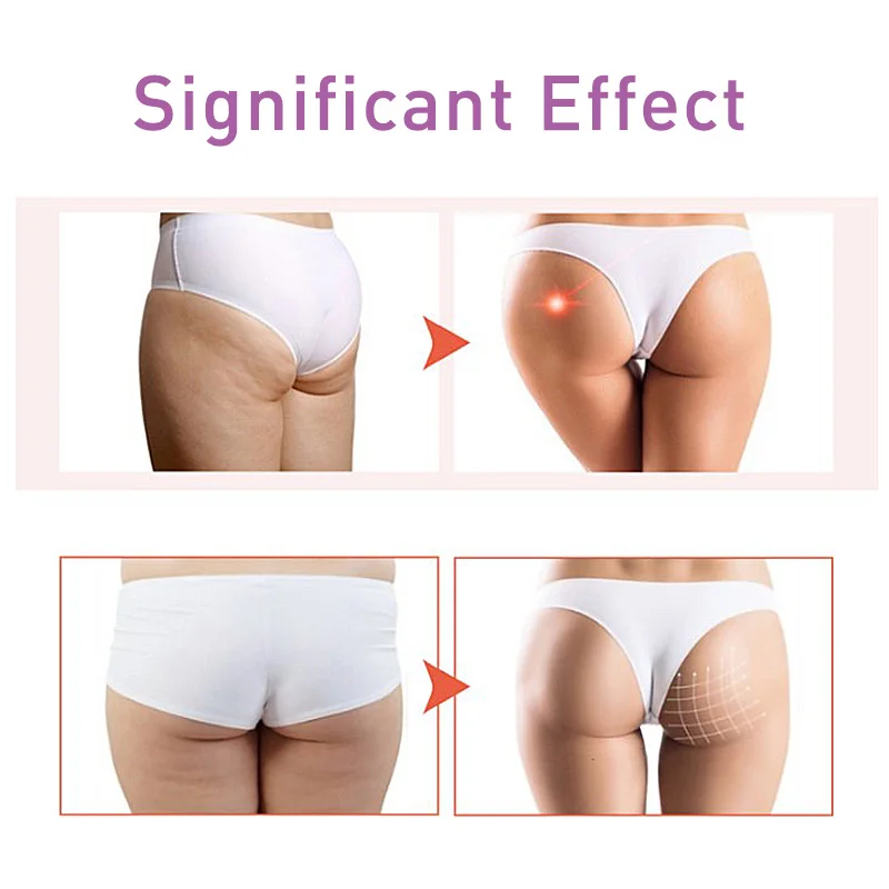 Сексуальное масло для улучшения ягодиц 15 мл |