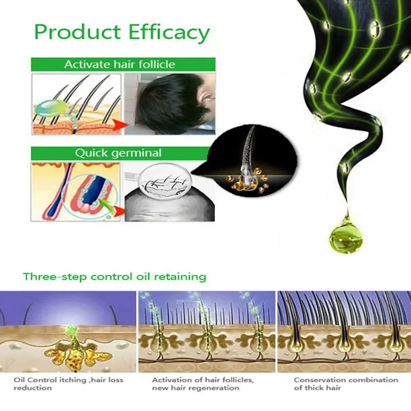 

Natural Herbal Extract Shampoo Moisturizing Anti-Hair Loss Shampoo Improve Hair Quality