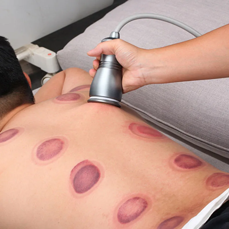 

Electric Scraping Machine Body Cupping Massage Gua Sha Ventosas Anti Cellulite Fat Burner Vacuum Suction Pumps Therapy Apparatus