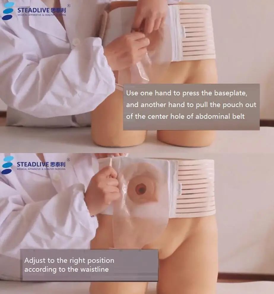 Большой пояс Ostomy! Прочный и эластичный колостомический утягивающий пояс для занятий спортом! Fix ostomy сумки и избегайте парабомальной грыжи 4 размера