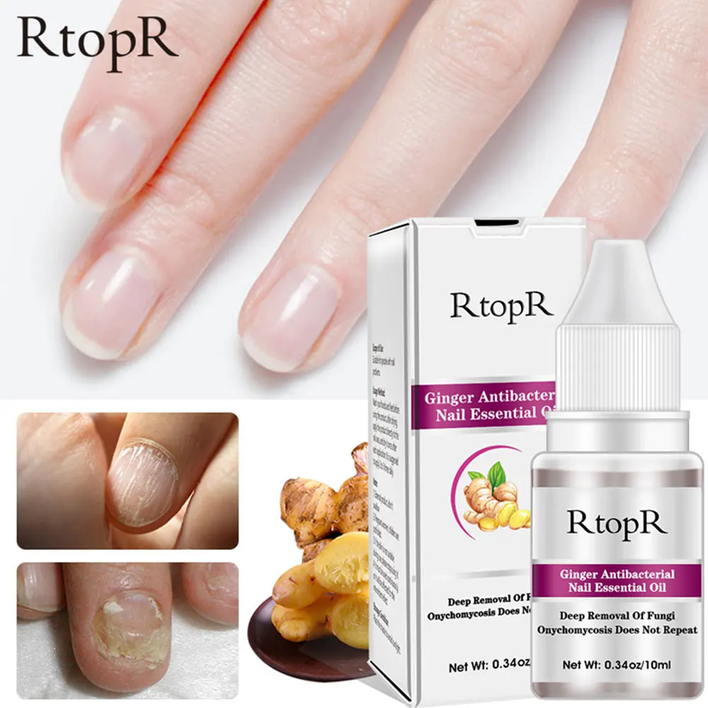 Средство для лечения грибка ногтей 10 мл жидкость удаления имбиря онихомикоза