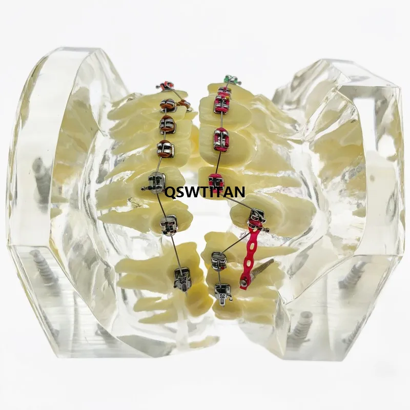 Стоматологическая Ортодонтическая модель зубов прозрачная с кронштейнами |