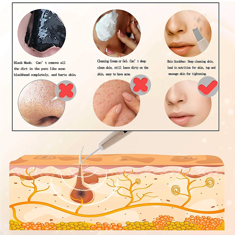 Ультразвуковой ионный скребок для кожи ухода за кожей лица удаление черных