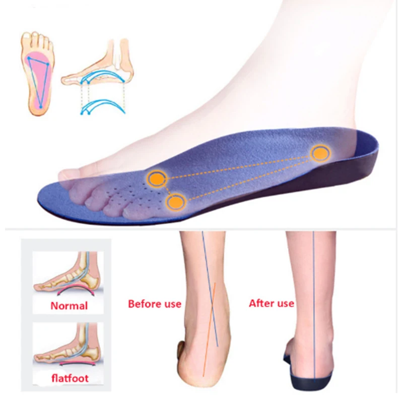 Ортопедические InsolesFlatfoot ортопедические Cubitus Varus ортопедические стельки для ухода за ногами унисекс дезодорирующие стельки