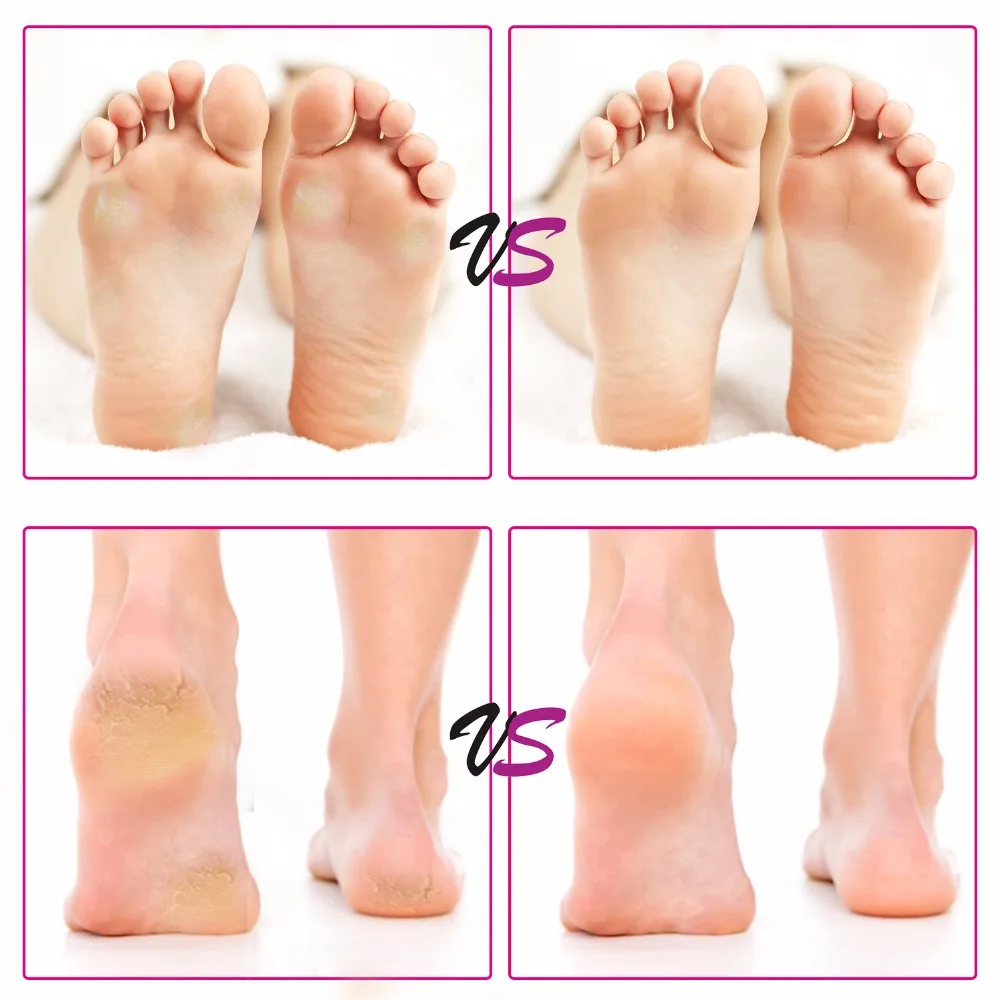 Электрическая пилка для ног твердый мертвый полировщик кожи инструмент удаления