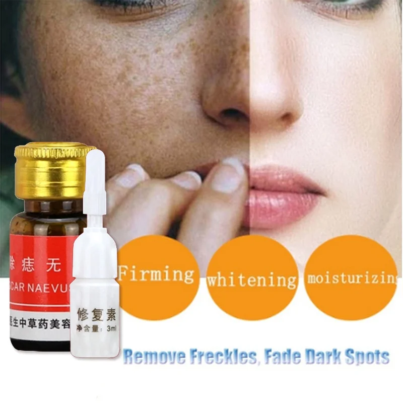 

Mole&Skin Tag Removal Painless Dark Spot Removal Face Wart Tag Freckle Removal Cream Oil Plaster 30ML