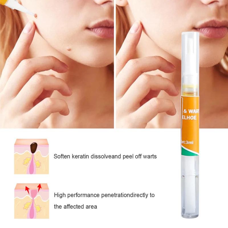 1/2/3 шт. кожу средство удаления бирок половых органов для борьбы с пигментацией