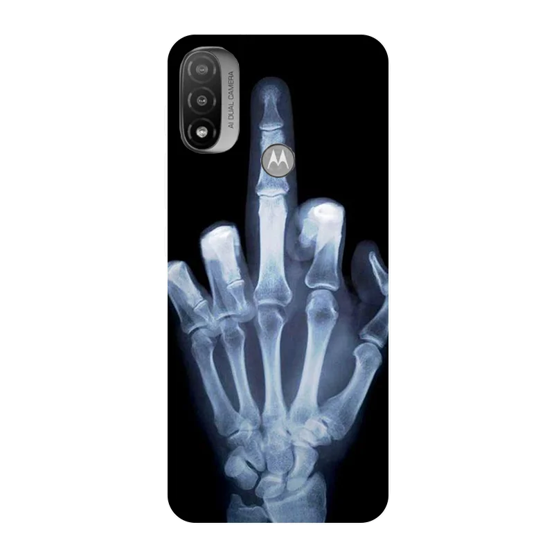 phone case for motorola moto e20 cover for moto e20 case silicon soft flower painted funda for motoe20 e 20 2021 protective case free global shipping