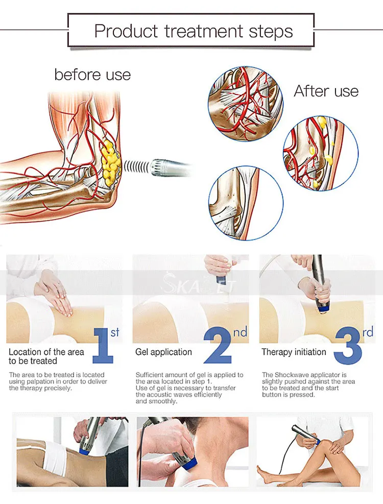 SW7 Pro Mini Plantar Fasciitis ED 1000 ударная волновая терапия для похудения тела удаление жира Shockwave машина для эрекционной дисфункции