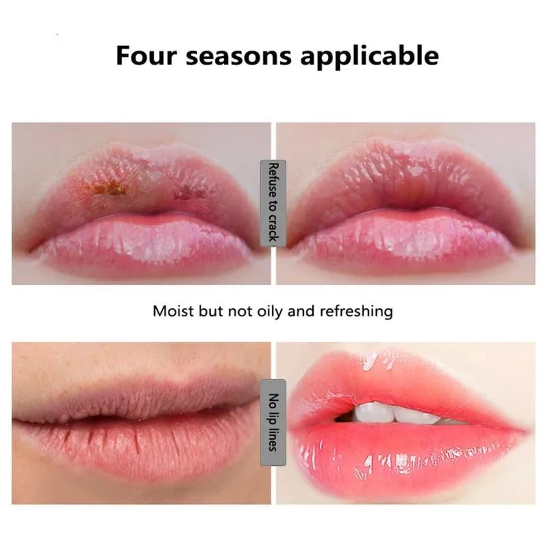 

Capsule Vitamin E Lip Balm Sleep Lip Oil Protective Nourishing Lip Essential Oil Night Sleep Reduce Fine Lines