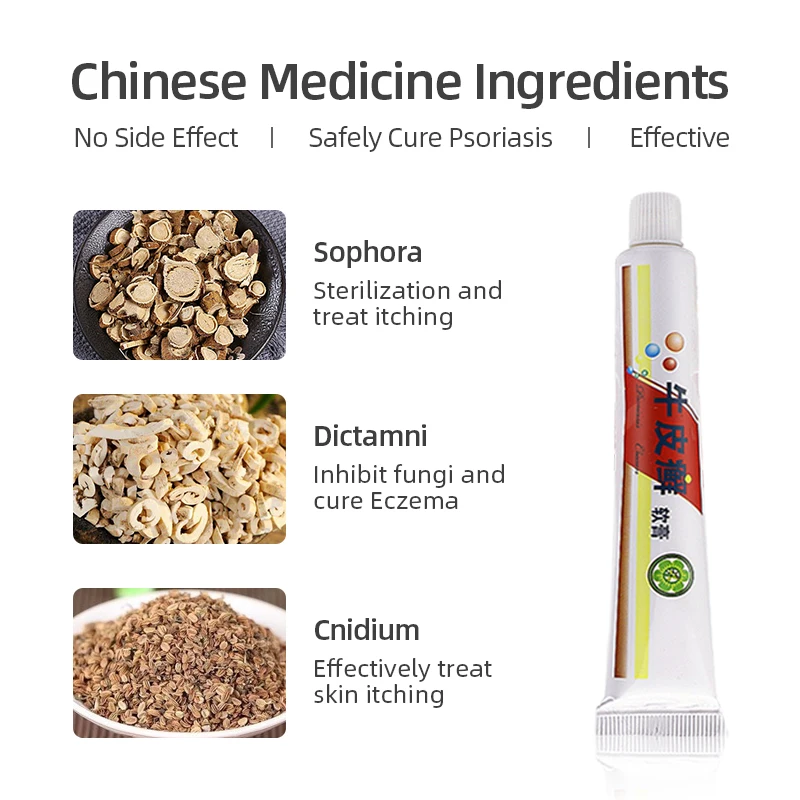 Натуральный травяной медицины псориаз мазь антибактериальные дерматит зуда для