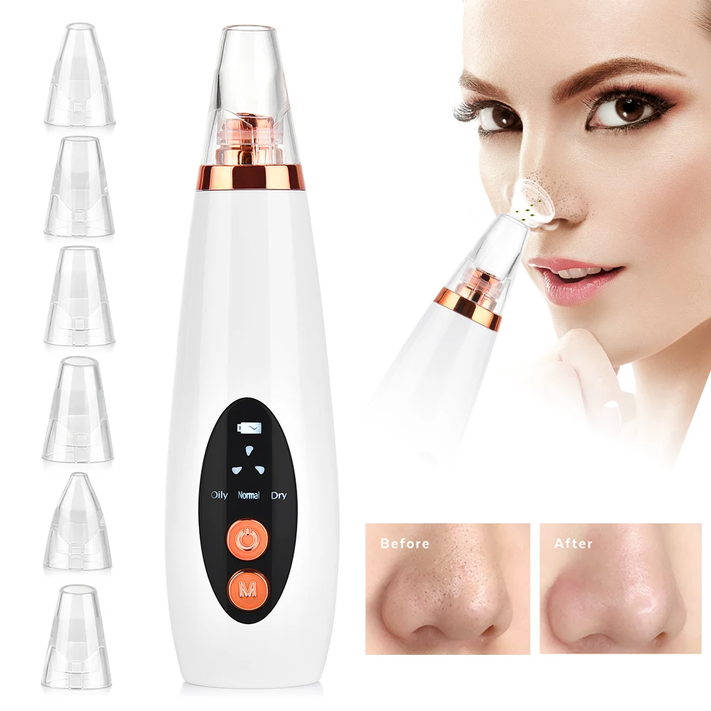 

Facial Pore Cleaner Blackhead Remover Vacuum Suction Cleaner Pore Acne Pimple Extractor Removal Device Skin Care Beauty Tool Hou