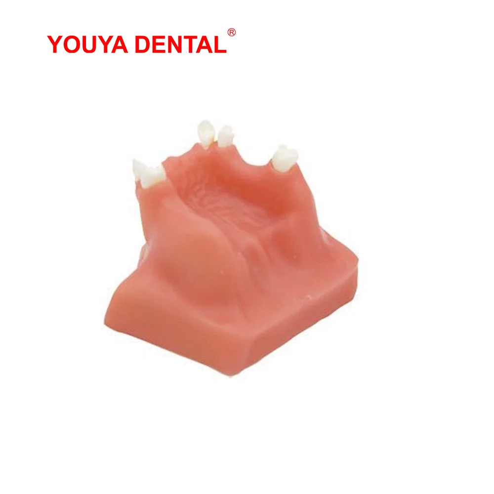 Зубная модель зубов Maxillary зубной имплантат для обучения стоматолога обучение