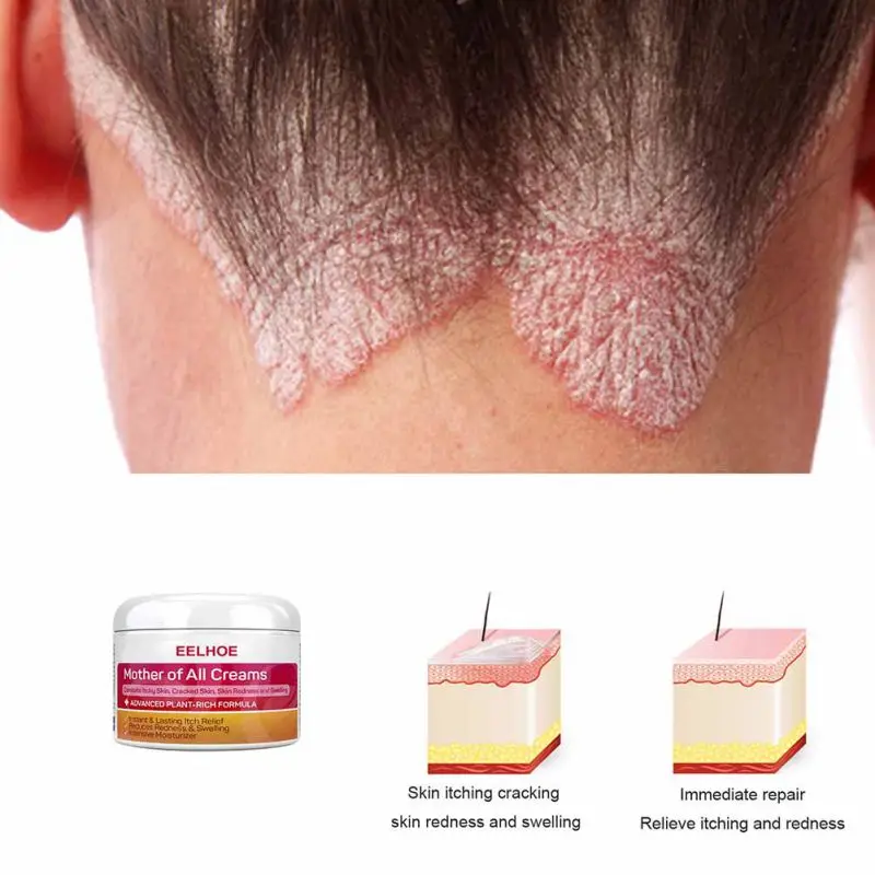 Восстанавливающее Средство для сухих зуд и чувствительную кожу регенерирующий