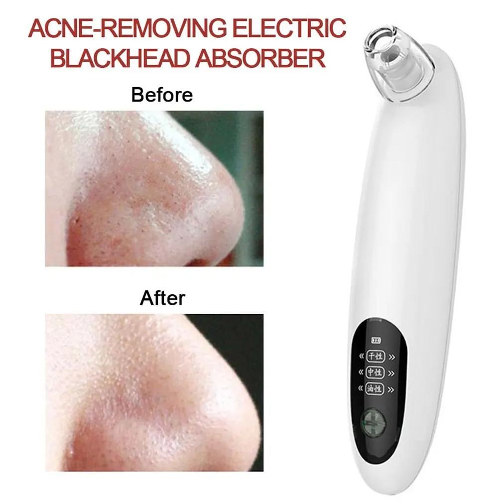 Electric Blackhead Remover Needles Acne Black Spot Extractor Vacuum Suction Deep Cleansing Machine Exfoliating Pore Cleaner | Красота и