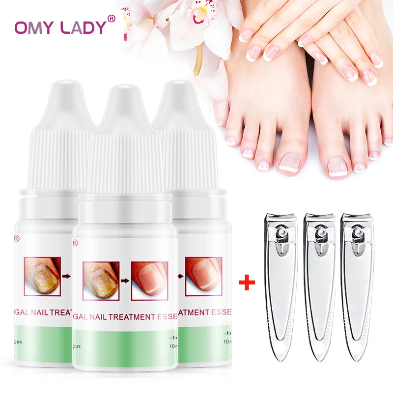 OMY LADY 3 шт. лечение грибковых ногтей эссенция и отбеливающий гель для удаления грибка ног анти-инфекция Paronychia Onychomycosis