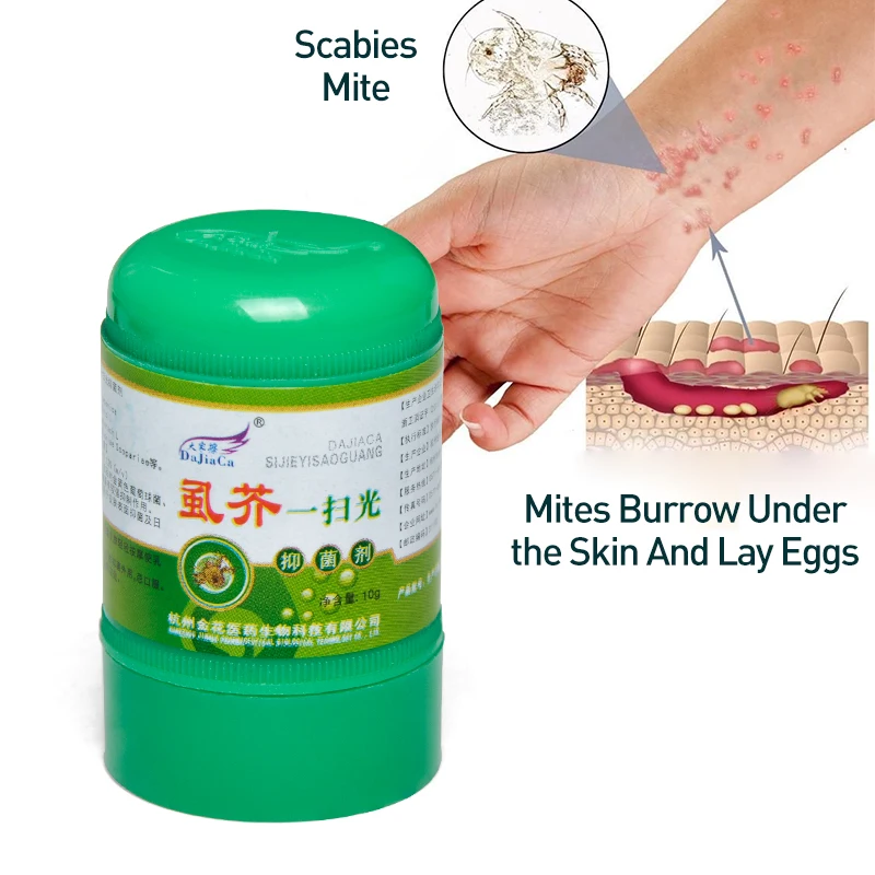 1 шт. травяной крем от чесотки лобковых вшей клещей подмышек интимный дерматит