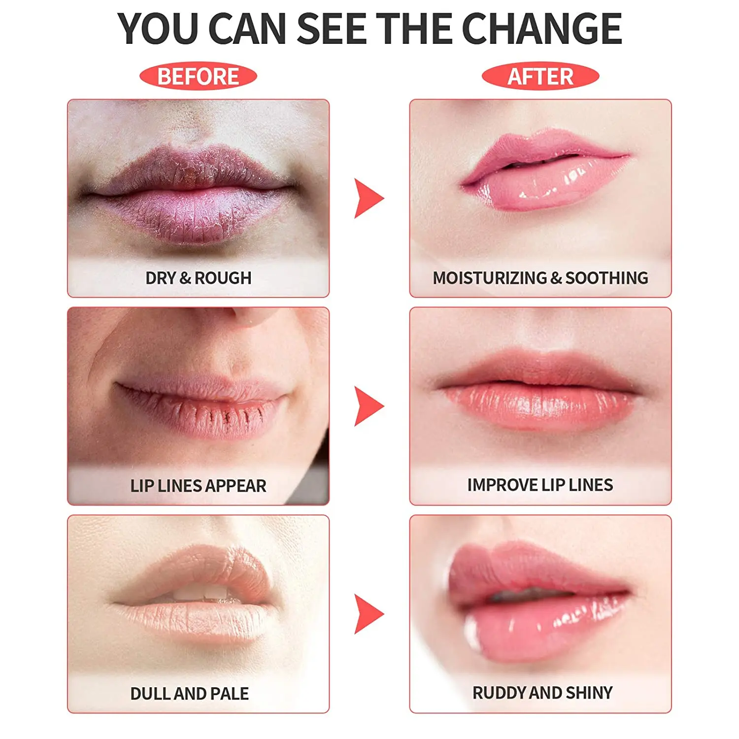 Светодиодный инструмент для ухода за губами устройство увеличения объема губ