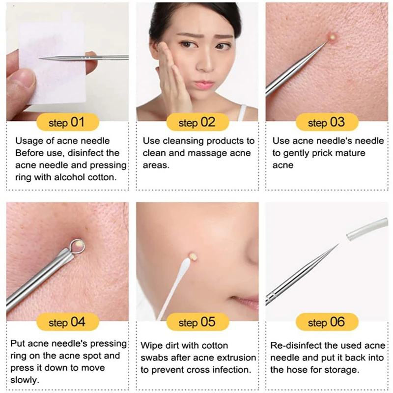 Stainless Steel Silver 4pcs Blackhead Comedone Acne Pimple Blemish Extractor Remover Tool For Face Skin Care | Красота и здоровье