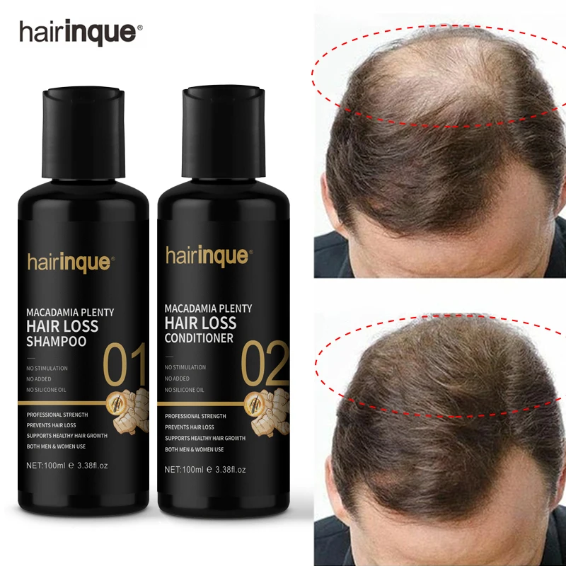 

Hair Growth Shampoo Conditioner Thickener Anti Hair Loss Products Grow Hair Regrowth Scalp Treatment Serum Oil Men Women 100ml
