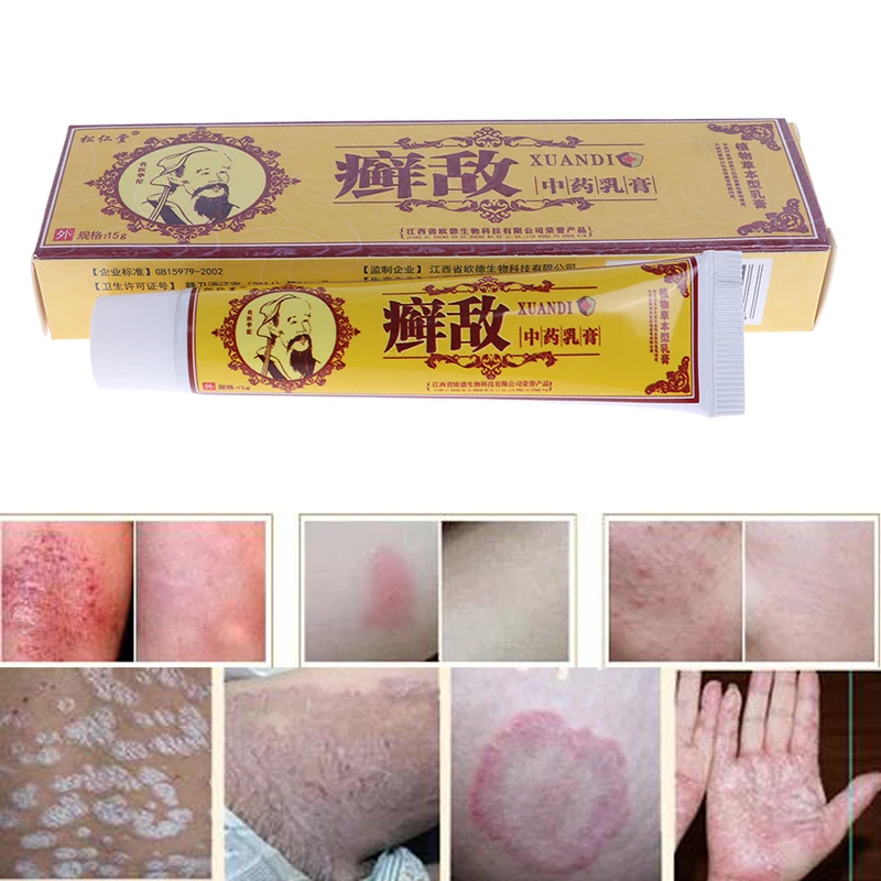 

Psoriasis Eczema Cream Antifungal Antibacterial Itchy Cream Skin Care