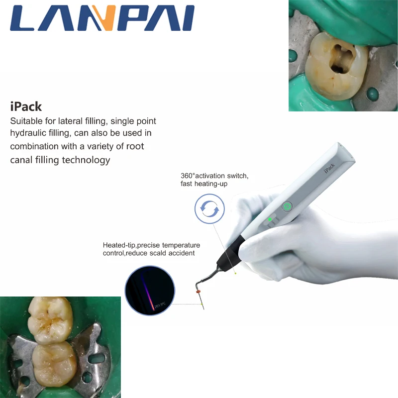 

Denjoy Dental Pulp Filling Endo System Cordless Wireless Obturation Gutta Percha Heated Pen