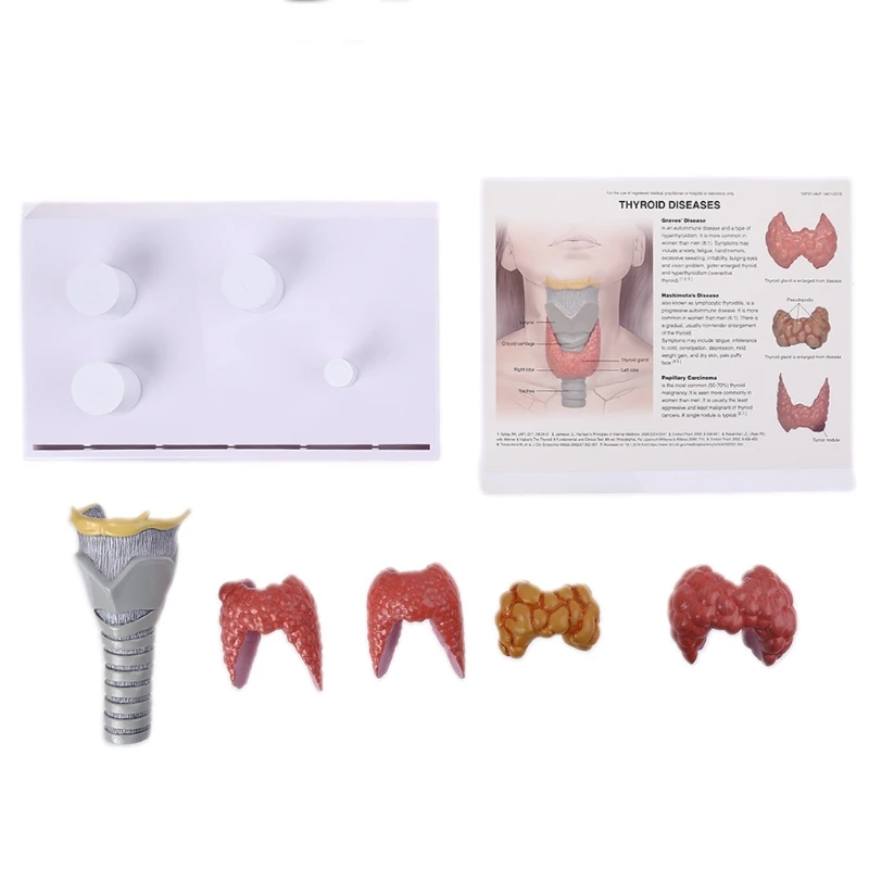 

Human Anatomical Thyroid Gland Model Pathology Anatomy Digestive System Display