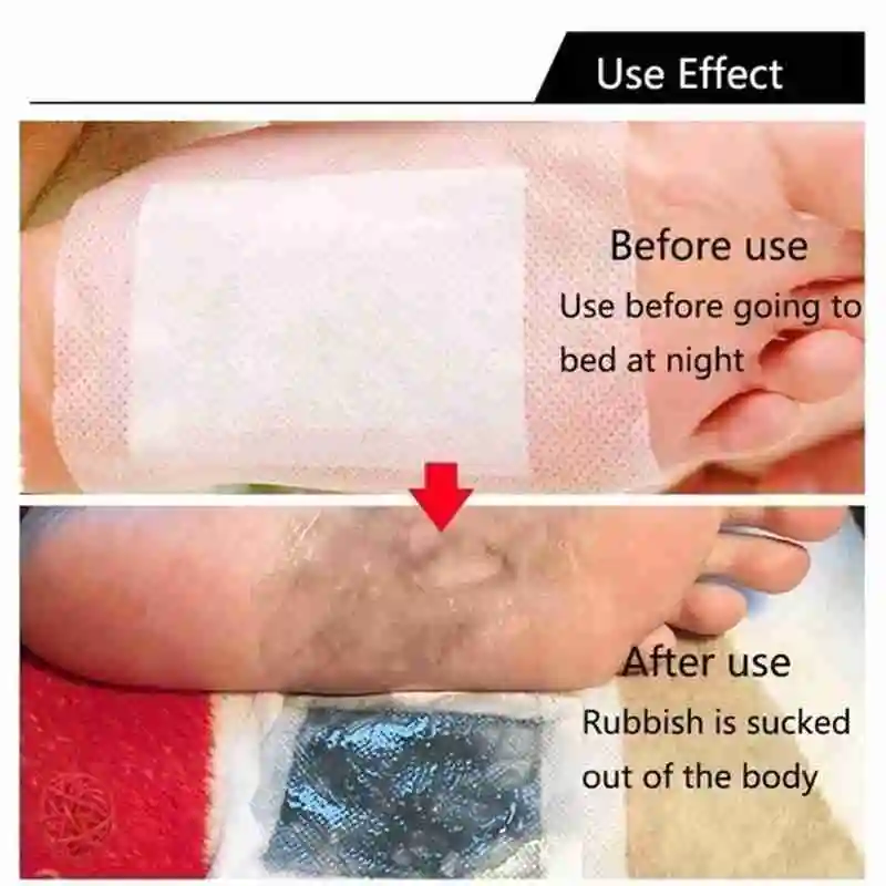 

10 Pcs Detox Foot Patches Artemisia Argyi Pads Toxins Feet Slimming Cleansing Herbal Body Health Glue Pad Weight Loss