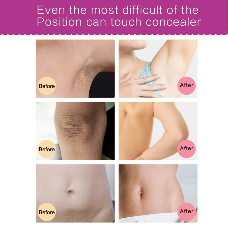 ELAIMEI 2 шт. натуральная кожа ремонт ног коленей и частных частей избавьтесь от