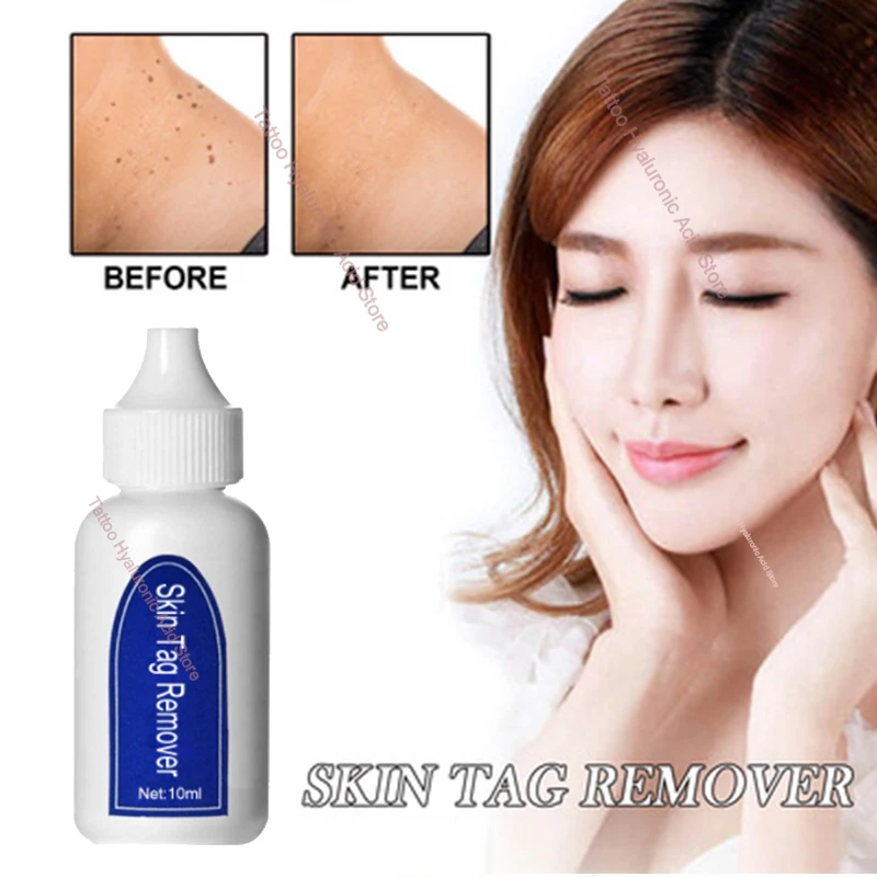 

Средство для удаления рубцов на коже, медицинская Жидкость против крот, быстрое удаление бородавок, пятен, прыщей, 12 часов, средство для уход...