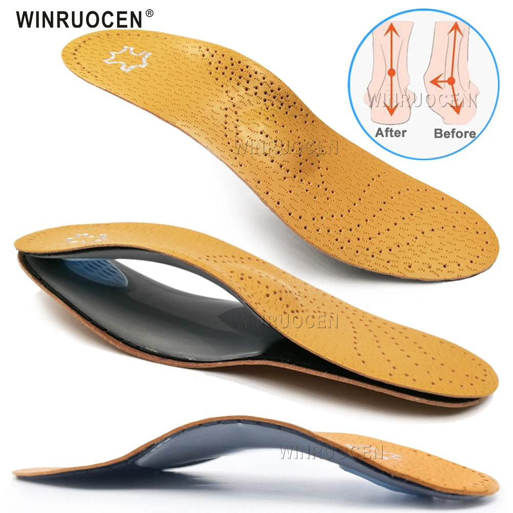 

Leather Orthotic Insole For Flat Feet Arch Support Orthopedic Shoes Sole For Plantar fasciitis Feet Men Women O/X Leg Corrected
