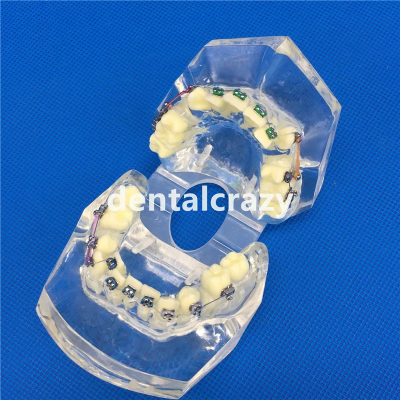 Стоматологическая модель зубов прозрачная ремонта патологического имплантата