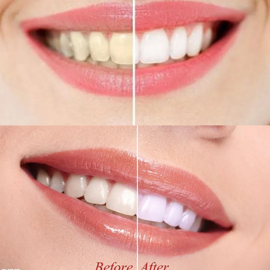 Бамбуковый уголь для зубов стоматологическая лаборатория гигиена полости рта