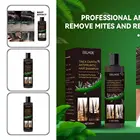 Эффективный шампунь для волос 100 мл улучшающий качество волос шампунь против зуда лосьон для волос шампунь для мужчин женщин мужчин