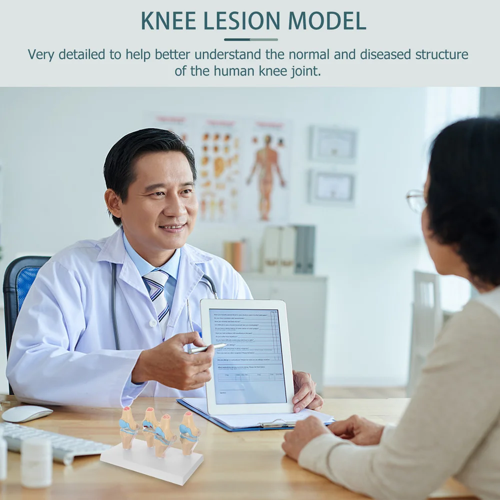 

Anatomical Knee Joint Model Set Knee Anatomical Model for Kids Learning Display